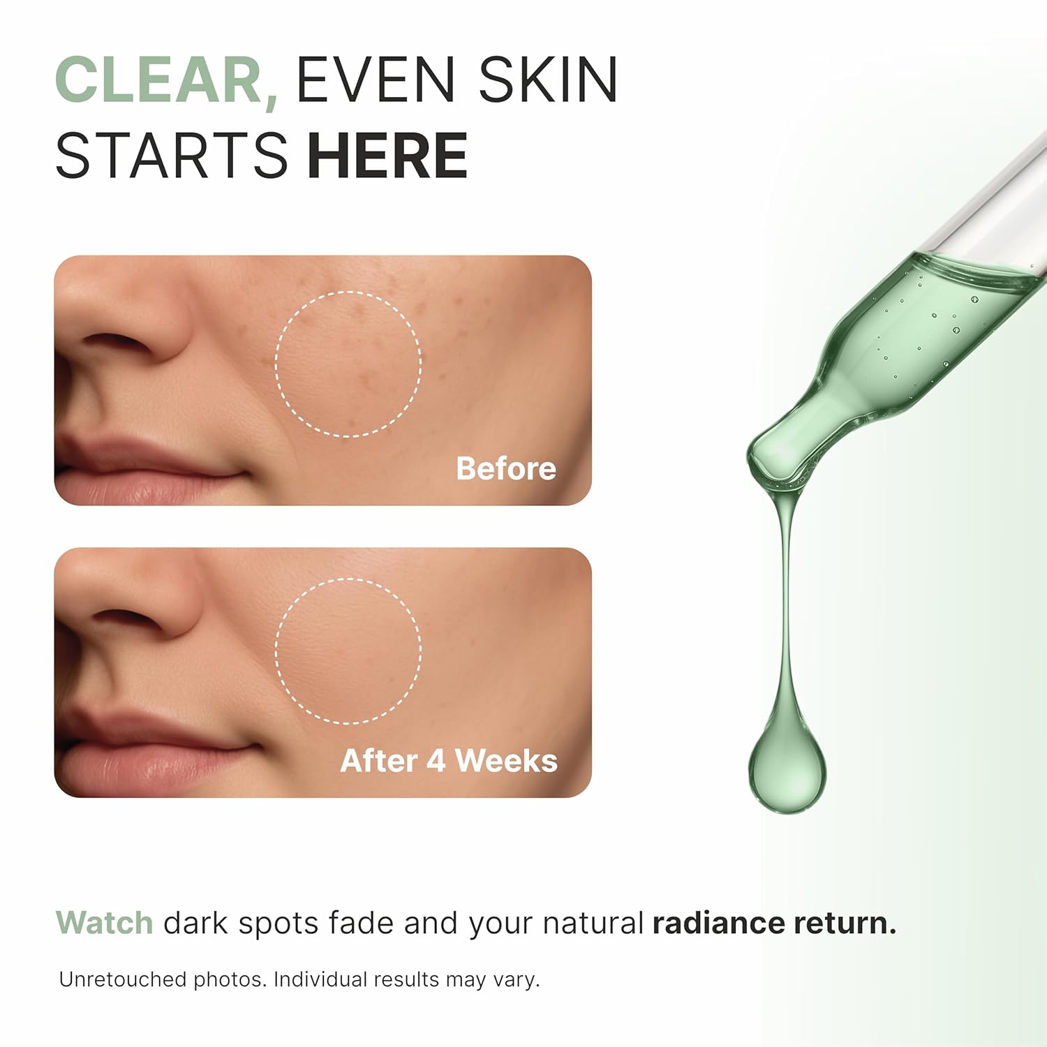 Dark Spot Serum | Ultra Gentle Niacinamide Serum for Face | Dark Spot Remover for face with Prebiotic Concentrate | Pore Minimizer for Face, Dark Spot Corrector & Redness Relief (30ml/1 oz) - Image 2