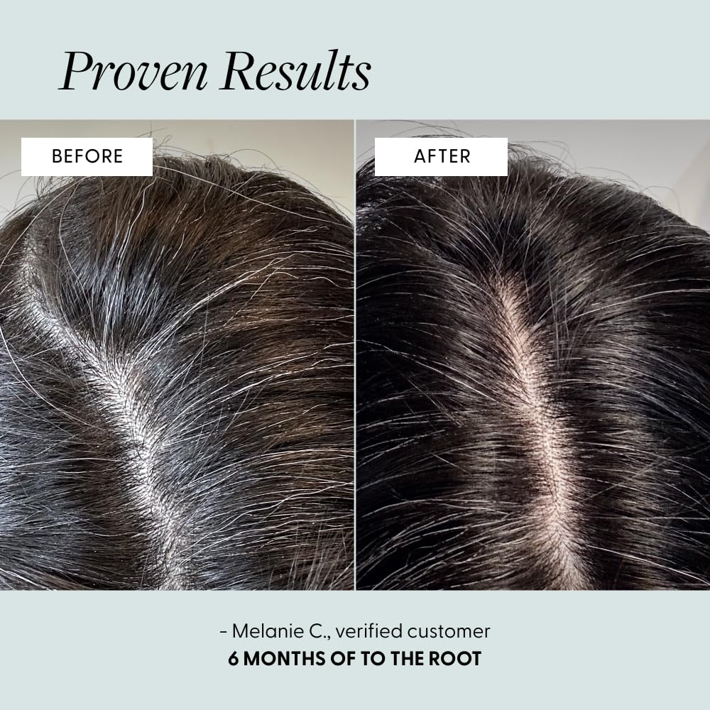 Arey To The Root Hair Serum for Women & Men | Slows Grey Hair Growth & Preserves Pigment in 3–6 Months | Anti Grey Scalp Serum for Healthier, Fuller-Looking Hair | Vegan & Oil-Free Formula (3 Months)