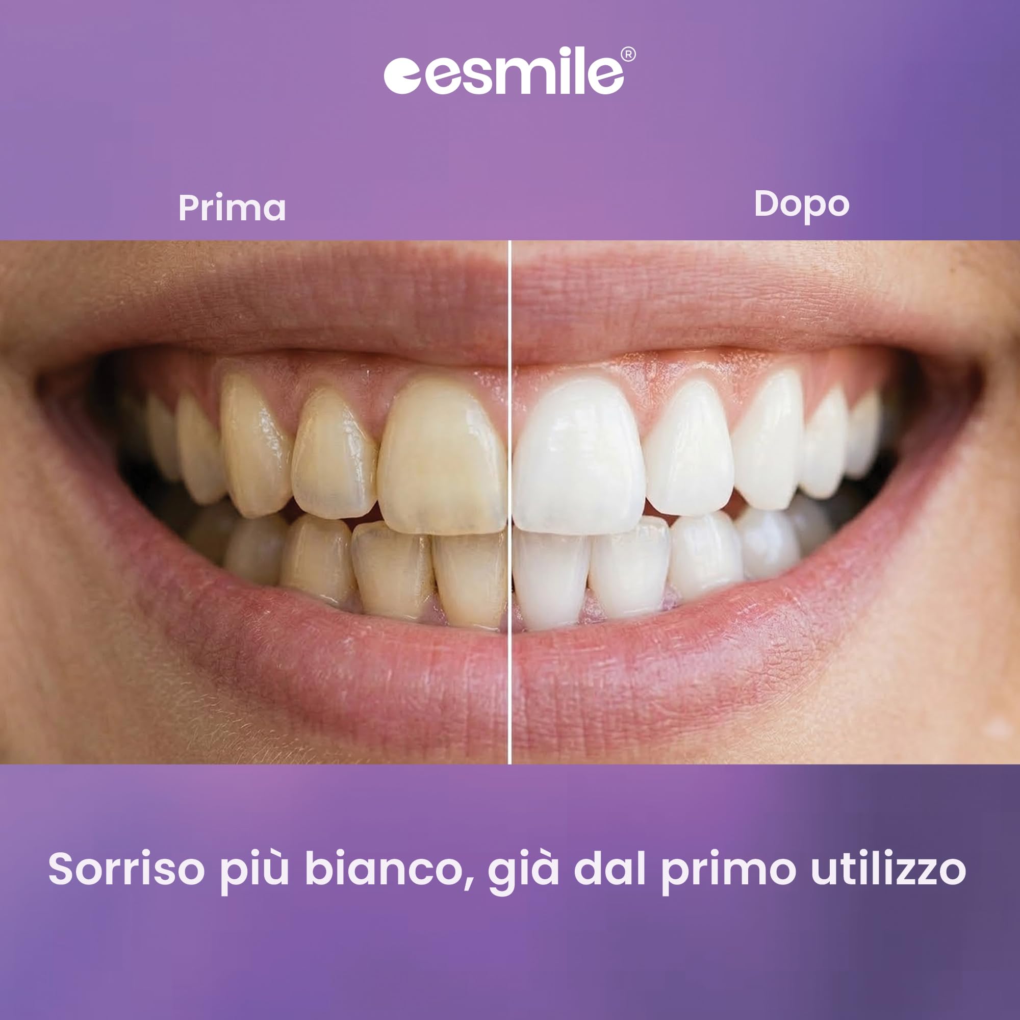 ESMILE: Kit EASYSMILE + Carbine Viola 100g