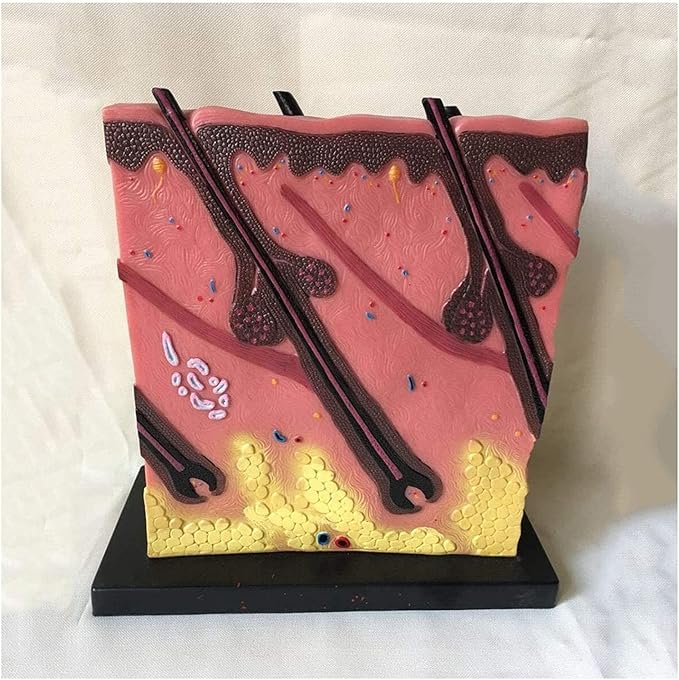 Medical Models, Skin Model Human Skin Anatomy Model Acne Epidermis