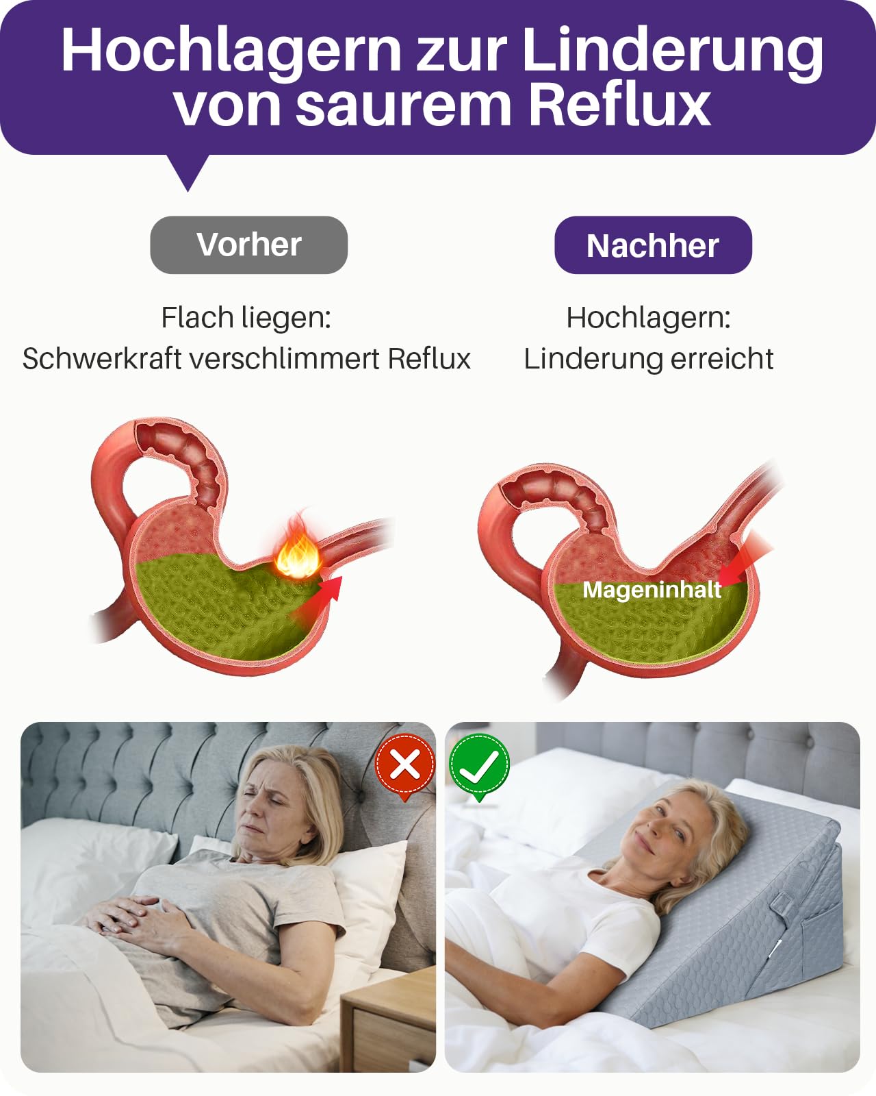 Kekoy Verstellbares Keilkissen Bett, Grau, 23 und 30,5 cm | Schlafapnoe, Säure Reflux, Rückenschmerzen, Schnarchen. Genesung – Memory-Schaum Reflux Kissen, waschbare Hülle, Griff