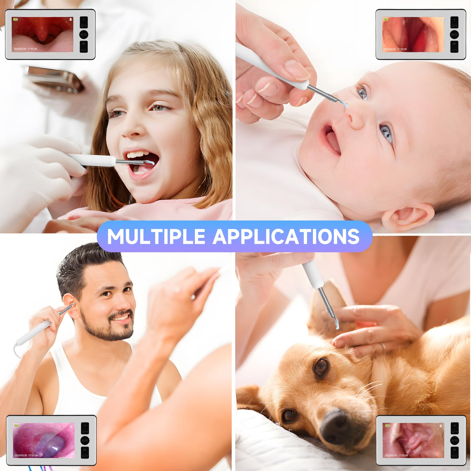 Otoscopio Limpiador de Oídos, 4.3 '' 1080p HD IPS Endoscopio de Oído con 6 Endoscopio LED, Boucher y Play, 3,5 mm Profesional Otoscopio con 64G Tarjeta de Memoria para Niños y Adultos