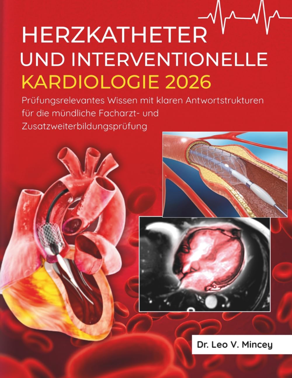 Herzkatheter & Interventionelle Kardiologie 2026: Prüfungsrelevantes Wissen mit klaren Antwortstrukturen für die mündliche Facharzt- und Zusatzweiterbildungsprüfung