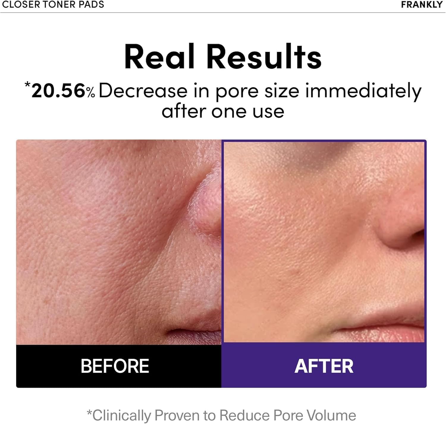 FRANKLY Pore Closer Toner Pads l Rice Jelly Pads with 9 Peptides, Vegan Collagen, Rice Extract l Pore Minimizer l Hydrating for All Skin Types l Korean Skin Care | 70 Count - Image 2