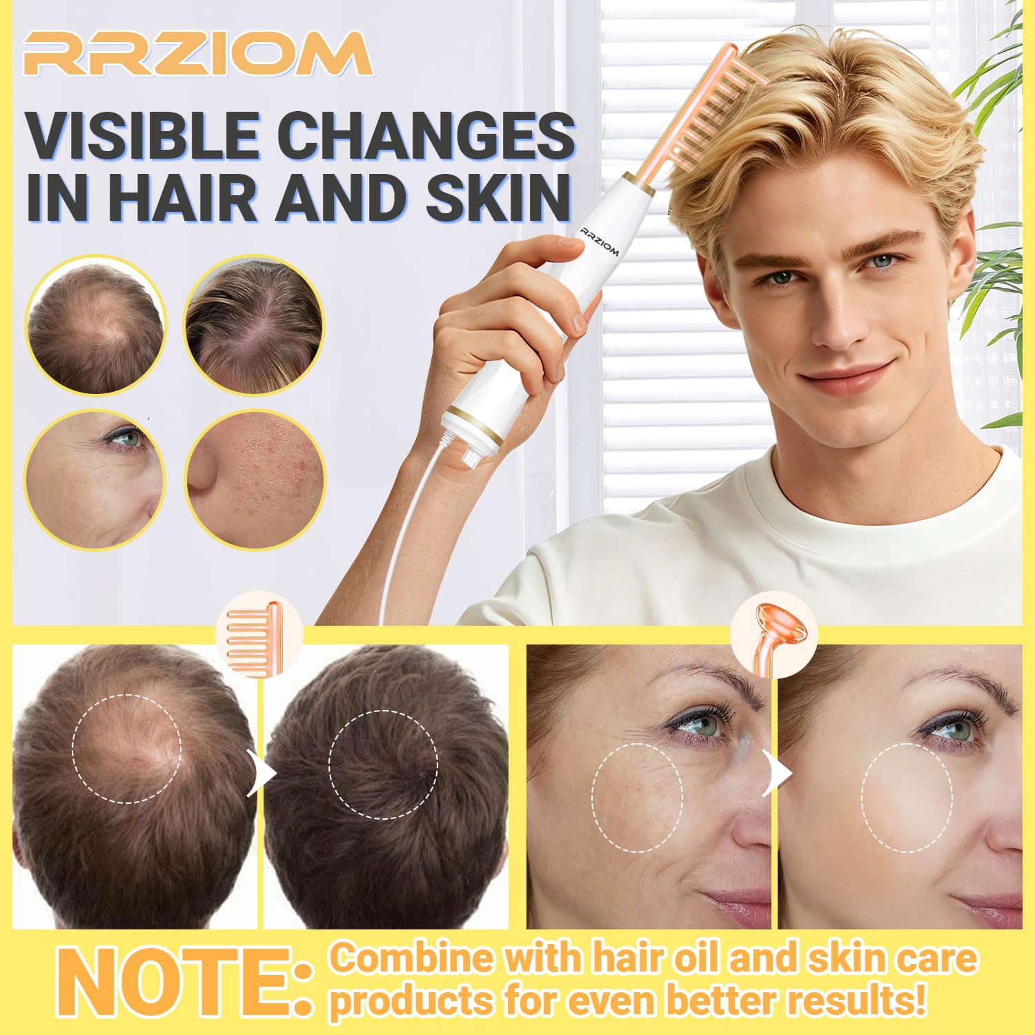 Kopfmassagegerät Elektrisch, RRZIOM 2 in 1 Rotlicht Scalp Massager Für Haare, Kopfhaut, Gesicht, Kopfhaut Massagebürste Elektrisch Für Haarwachstum, Portable Plug Desig (Orange)