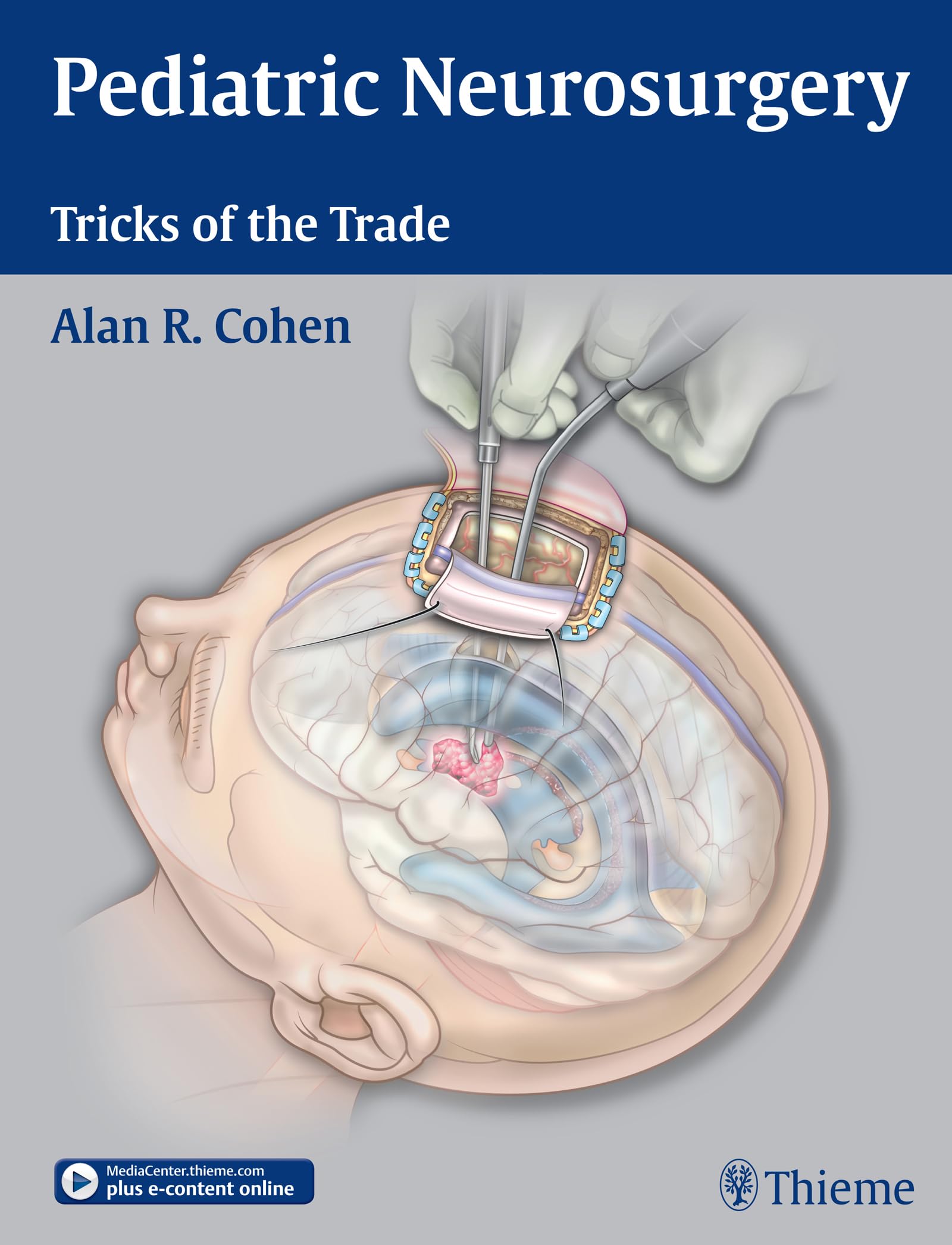 Pediatric Neurosurgery: Tricks of the Trade: 9781604068696