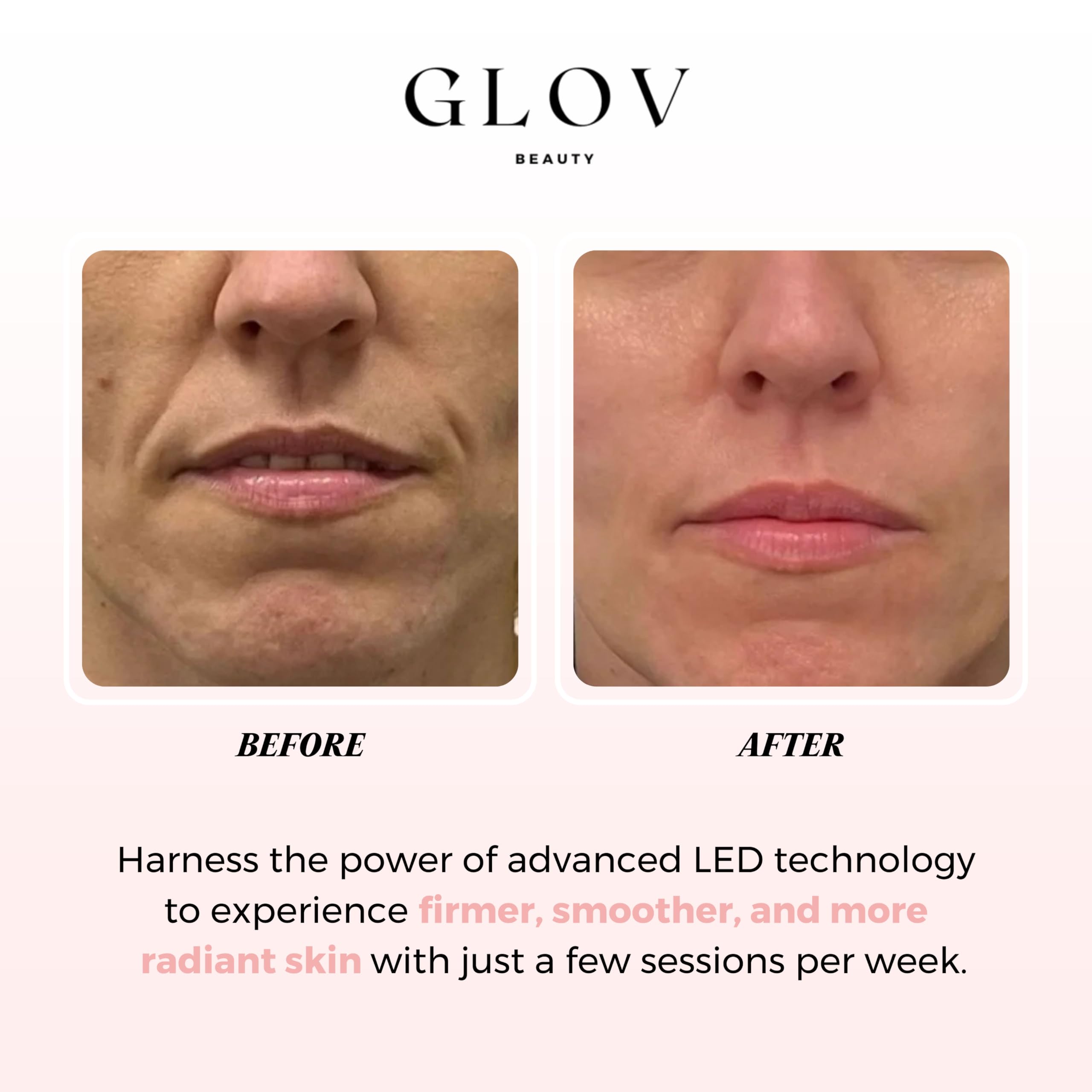 Glov Beauty - Anti-Aging LED Face Mask Red Light Therapy for Wrinkles, Fine Lines & Firmer Skin - Four Color Modes - Easy 10 Minute Session, Rechargeable, Facial Home Spa Device