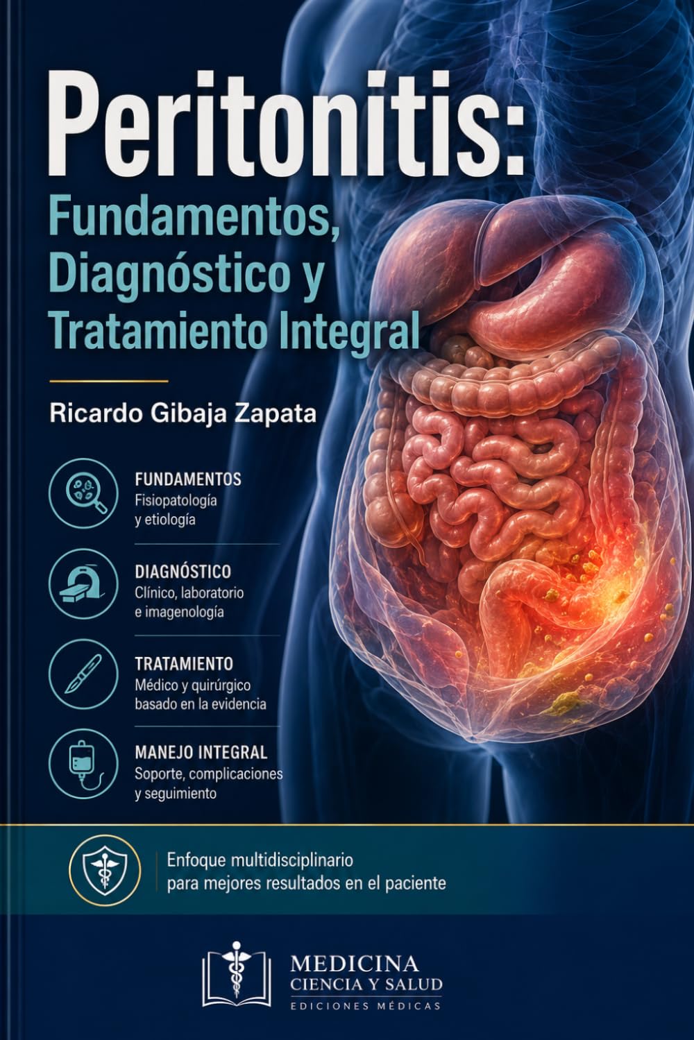 Peritonitis: Fundamentos, Diagnóstico y Tratamiento Integral