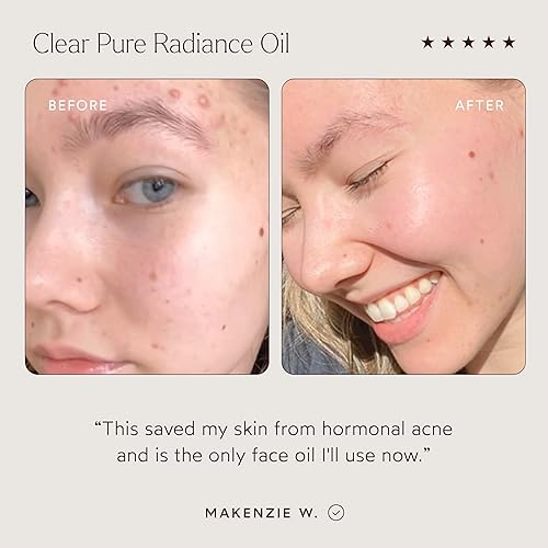 Miniatura 4 de True Botanicals Clear Pure Radiance Oil | Tipos de piel grasa | Aceite facial antienvejecimiento para piel propensa al acné | Trata líneas finas y