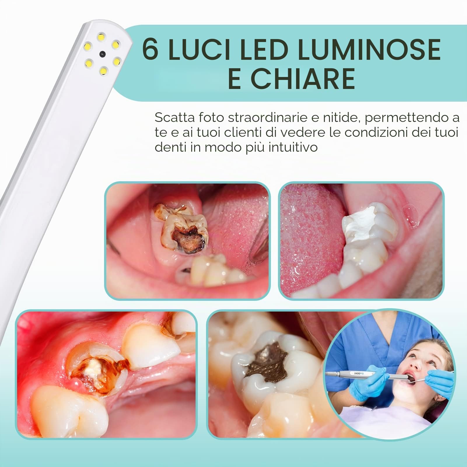 ProDENT Dental USB fotocamera intraorale PD740 pulsante di acquisizione funziona con vapore, SIDEXIS, Carestream e la maggior parte dei software di immagini