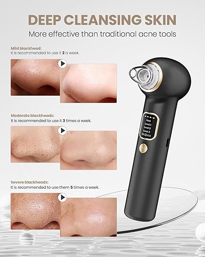 Miniatura 4 de Aspirador removedor de puntos negros 2025, aspiradora de poros con 3 potencia de succión, 5 sondas, removedor de vacío de puntos negros para mujeres