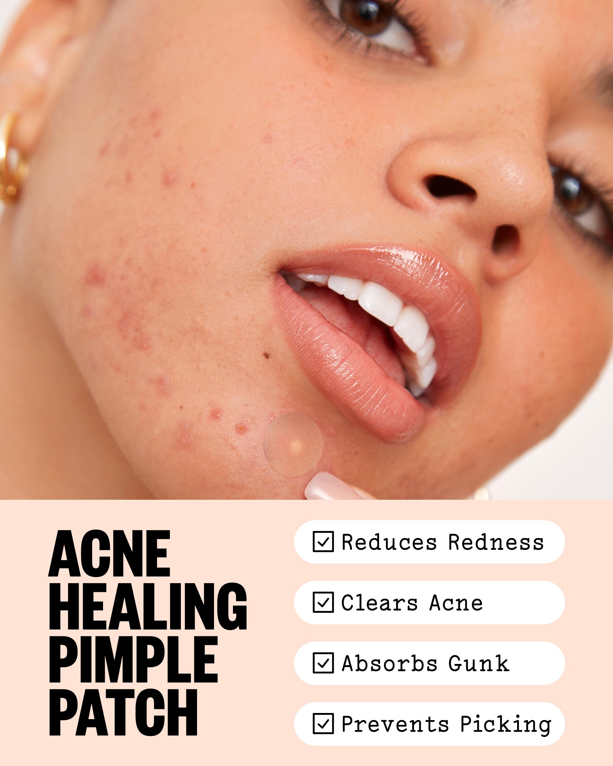 PEACE OUT Parches hidrocoloides para curar el acné, tratamiento de manchas de acné con ácido salicílico, retinol y aloe vera para imperfecciones y brotes (40 unidades)
