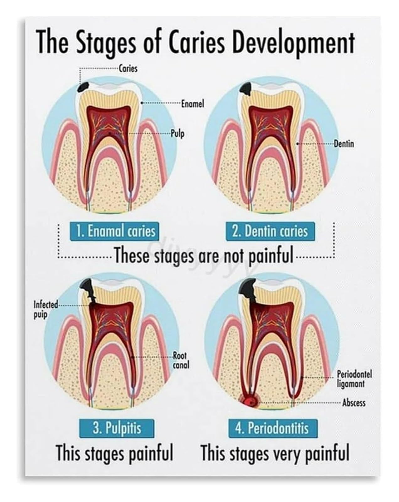 The Journey of Tooth Health An Illustrated Diagram Poster Canvas Wall-Art for Educational Center or Contemporary Lounge(Unframed,08x12inch(20x30cm))