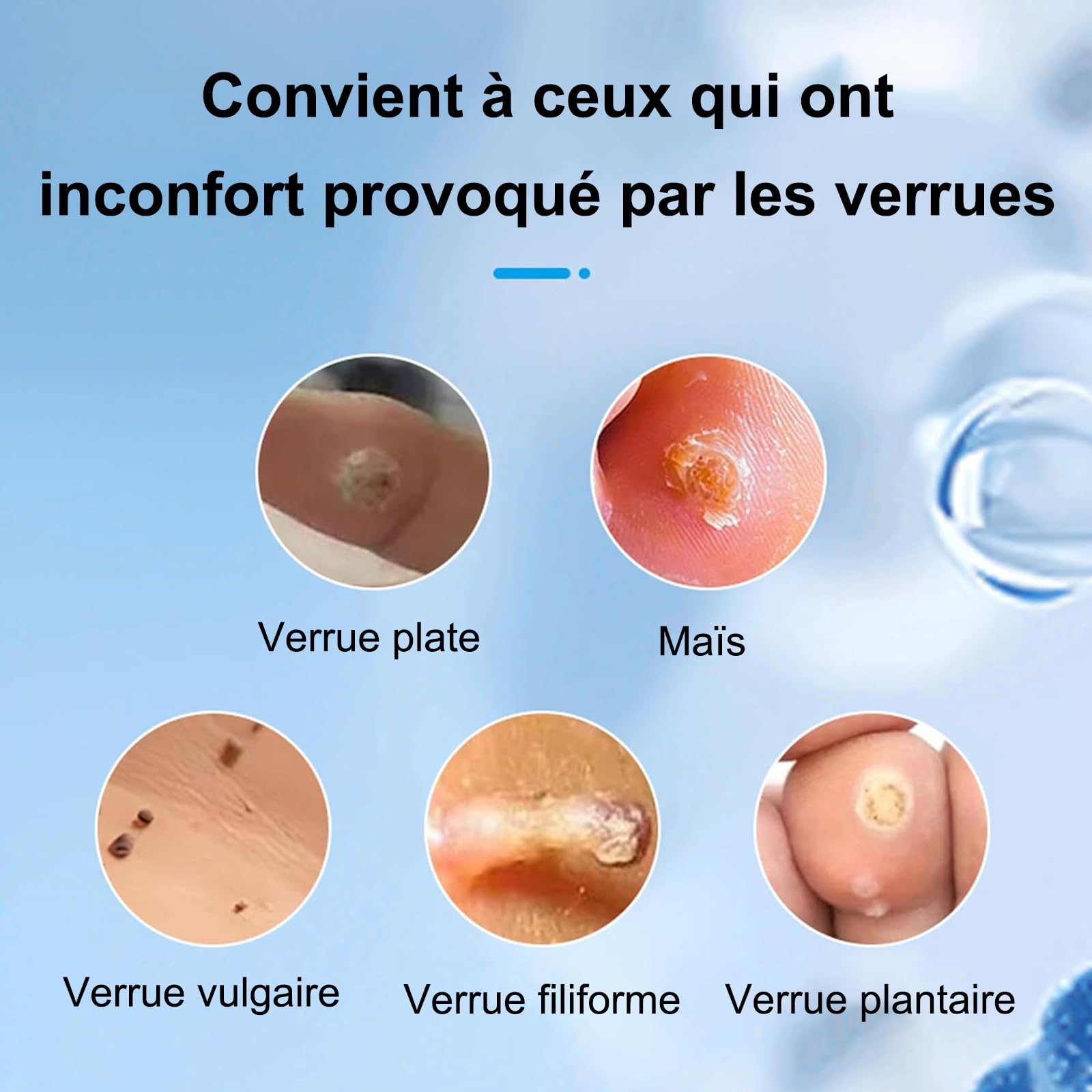 Crème D'élimination des Verrue Plantaire, Stylo anti-verrues 4ML