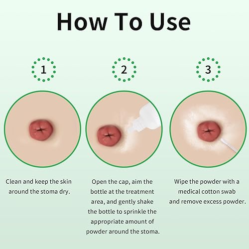Miniatura 4 de Polvo de estoma, polvo de barrera de piel protectora médica, polvo adhesivo de estoma de protección de preparación de la piel, suministros de