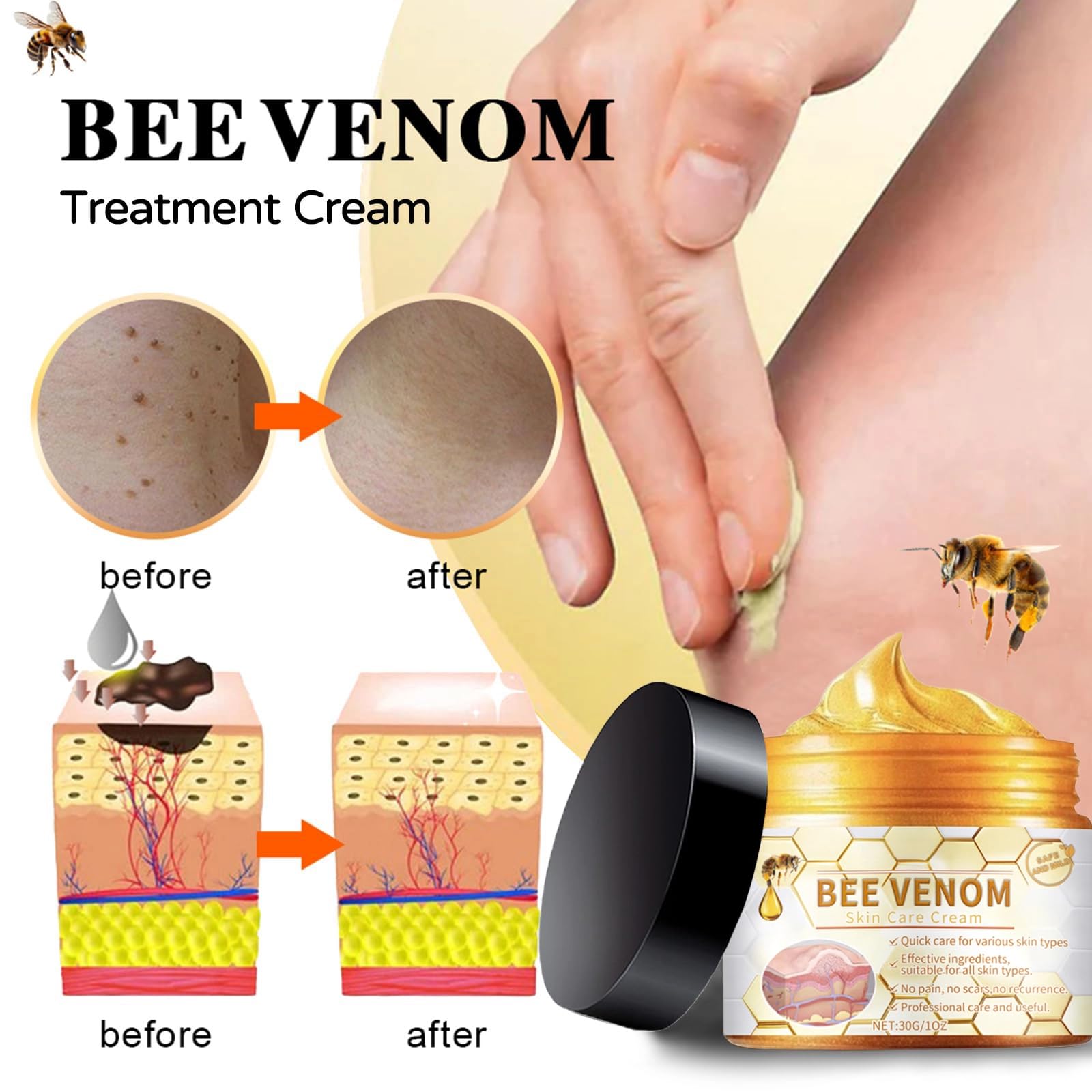 Amazon.com : Bee Venom Cream, 2026 New Bee Venom Marks Spots Removal Treatment Cream for All Skin Types (1) : Beauty & Personal Care