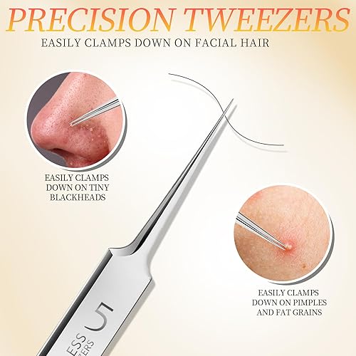 Miniatura 4 de Teenitor Juego de 4 pinzas profesionales para puntos negros y granos, pinzas de celda de acero inoxidable para puntos negros, espinillas, puntos