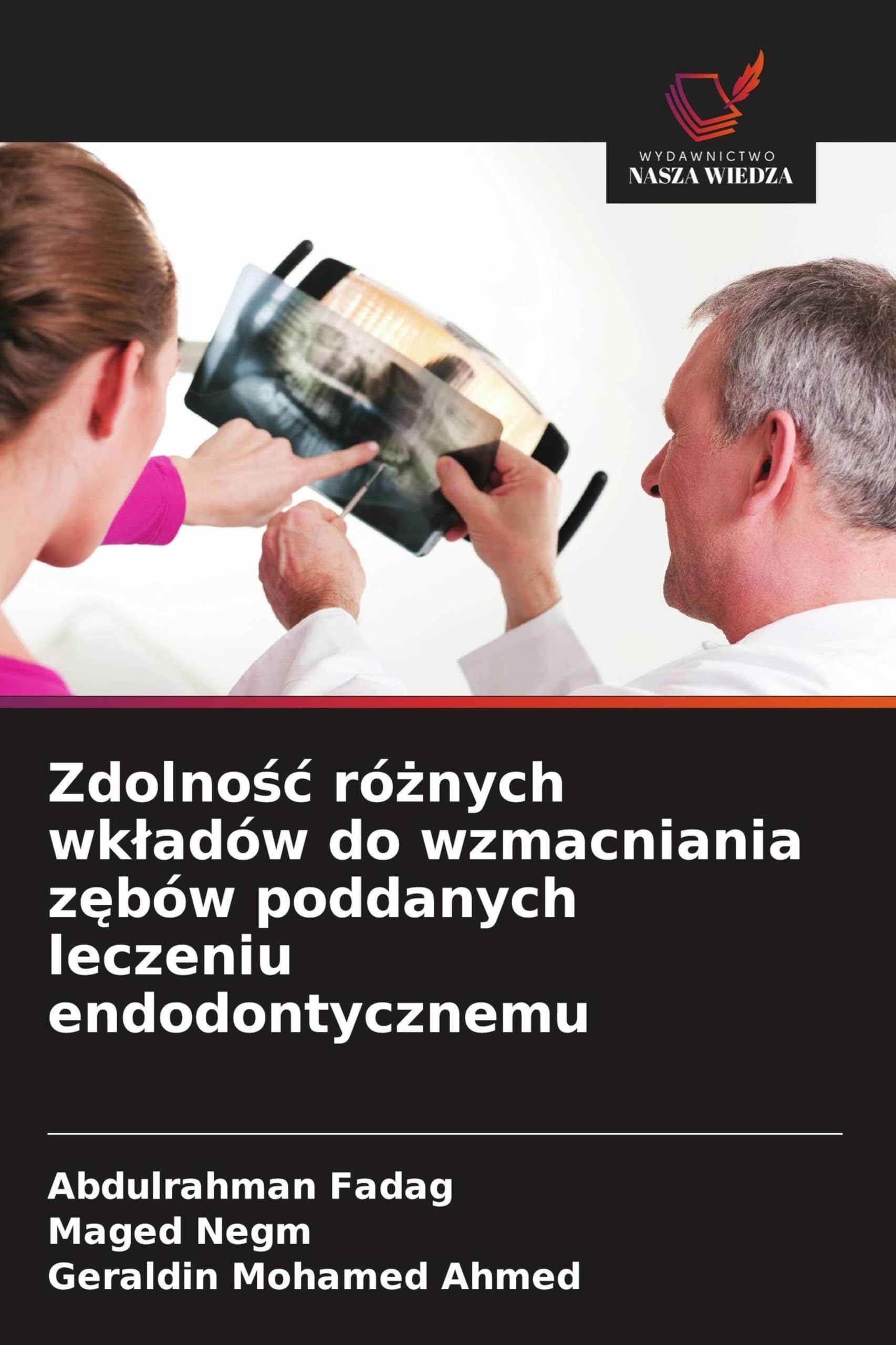 Zdolnośc różnych wkladów do wzmacniania zębów poddanych leczeniu endodontycznemu