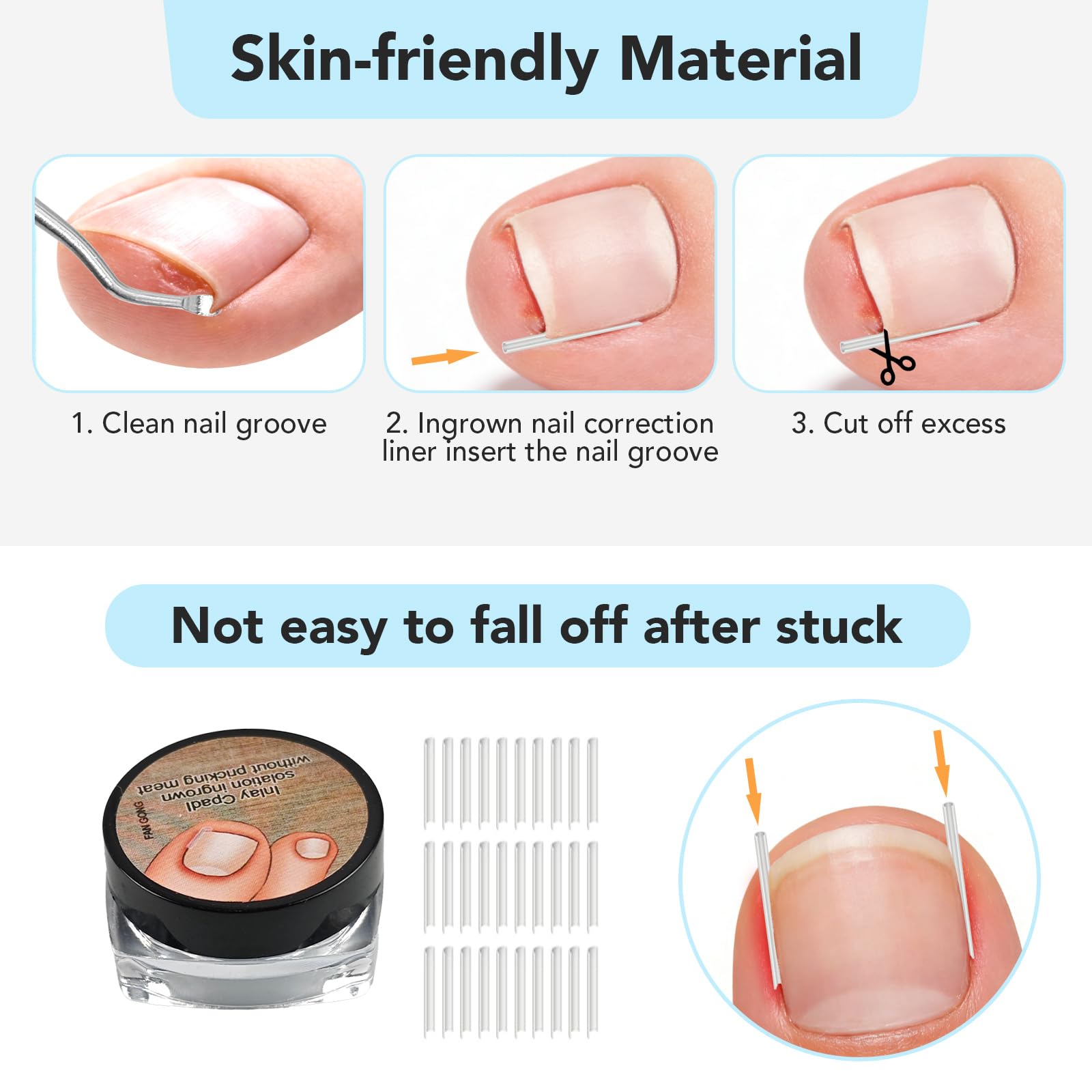 Juego de corrección de uñas encarnadas, juego de herramientas simple para uñas encarnadas, pinza para uñas de los pies con parche corrector de uñas, juego de cuidado profesional de los pies de
