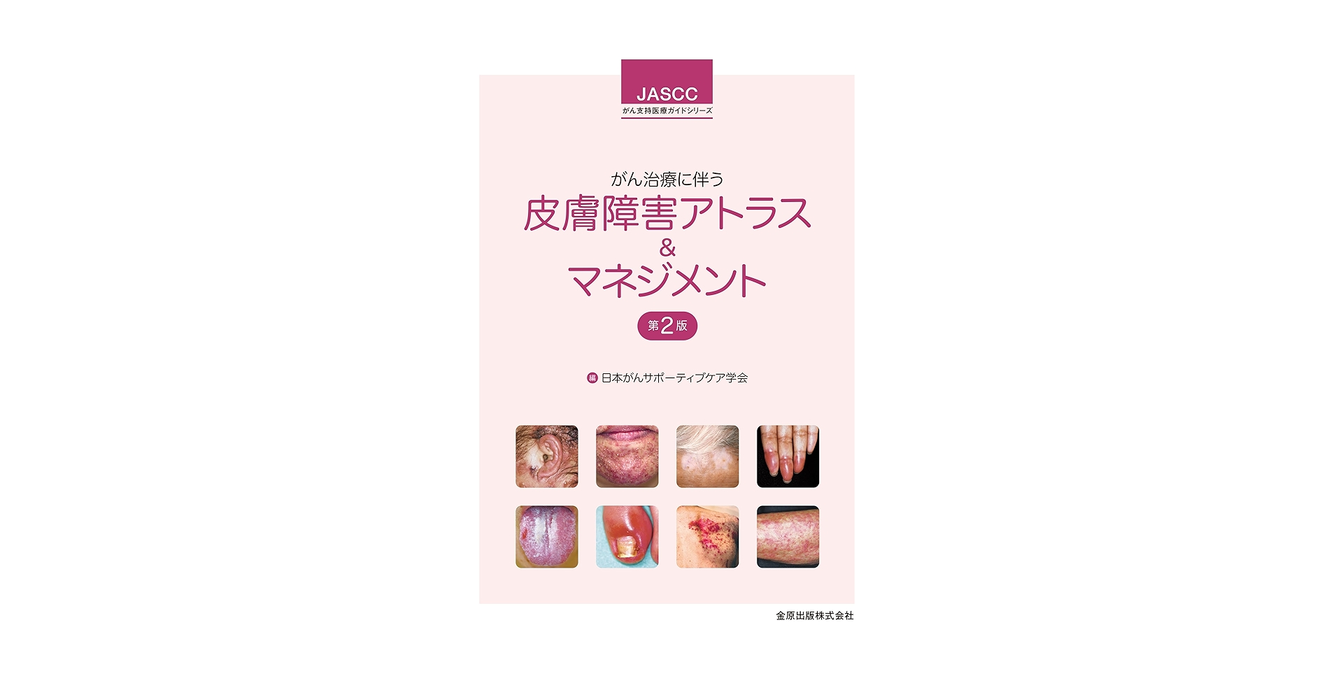 がん患者の皮膚障害アトラス 金原出版