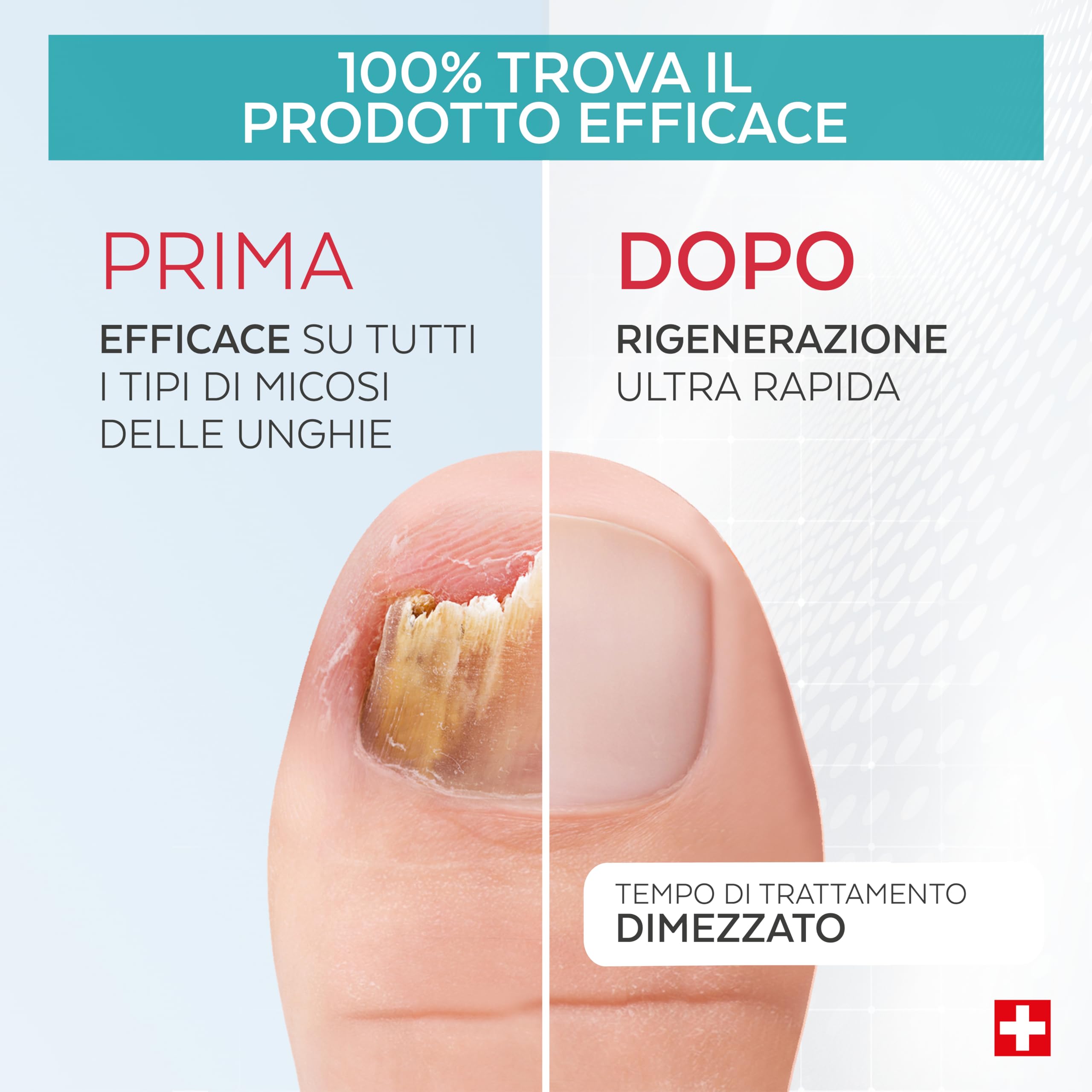 PODERM MICOSI UNGHIA PIEDE COMPLEMENT BOOSTER -Trattamento micosi unghie piedi – Dimezza durata trattamento – Non utilizzare solo – Prodotto in Svizzera