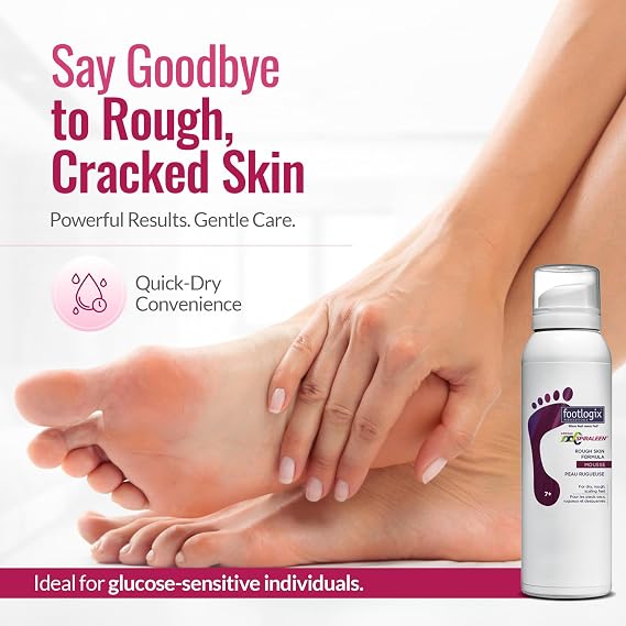 FOOTLOGIX Rough Skin Formula Mousse with Spiraleen 4.23 oz | Urea Foot Mousse with Tea Tree Oil & Aloe Vera | Lightweight Moisturizer for Dry, Rough Skin | Dermal Infusion Technology | Men & Women