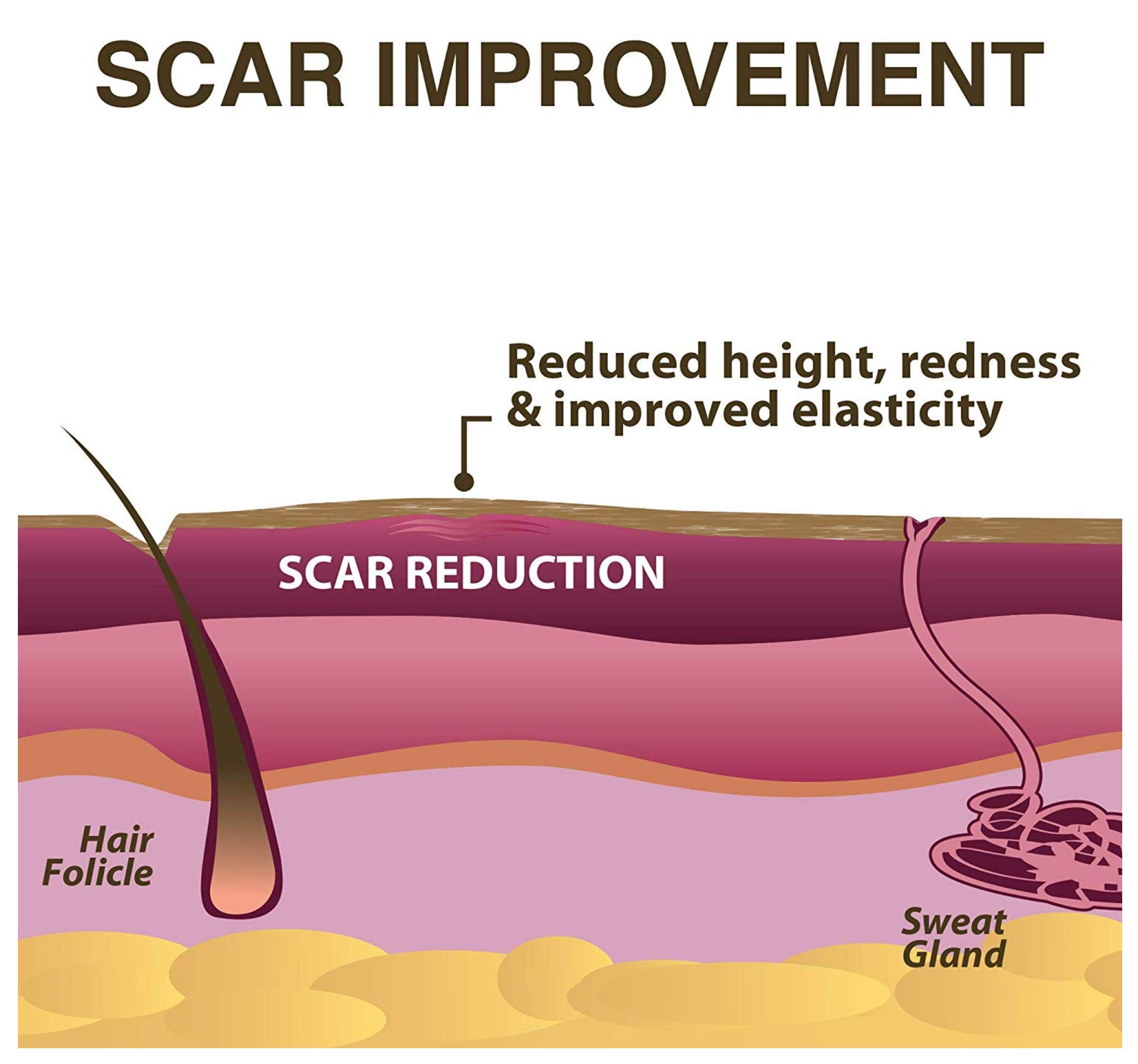 Buy BIODERMIS Epiderm Natural Scar Healing Plaster Areola Circles