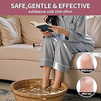 Vista 6 de Removedor eléctrico de callos para pies (rosa)