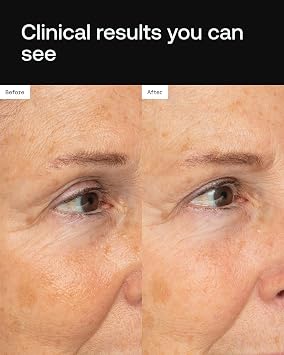 Angela Caglia Cell Forte Eye Creme Eye Cream with Exosomes, Peptides & Growth Factors | Stem CellPowered Skincare for Puffiness & Dark Circles | Luxury Skincare