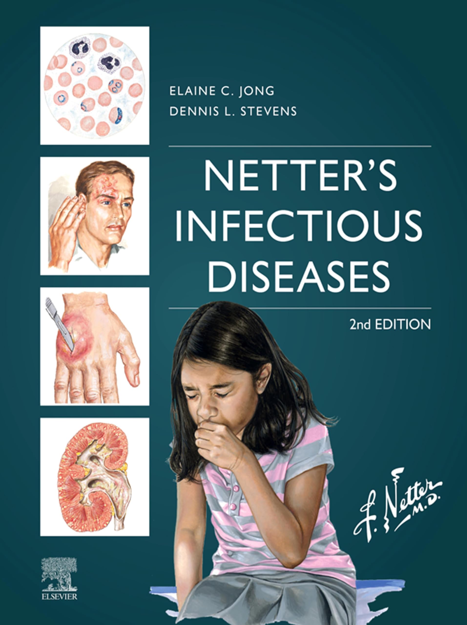Netter's Infectious Diseases - E-Book (English Edition)