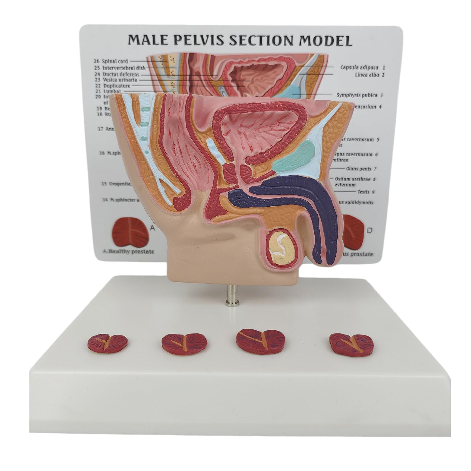 LKYLVEE Male Abdominal Cavity Anatomy Model - Bladder Abdominal Model - Male Abdominal Cavity, Bladder and Prostate Model - for Study Teaching Display,A,25cm