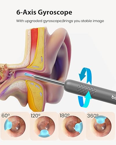Miniatura 6 de BEBIRD Herramienta de eliminación de cera de oídos con cámara HD, limpiador visual inteligente R1 mejorado con otoscopio, visor de oídos con 6 luces