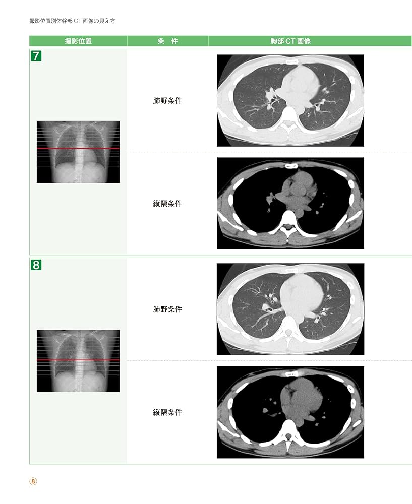 看護 看護アセスメント力を高める!画像検査まるわかり (NsCan) | 酒井