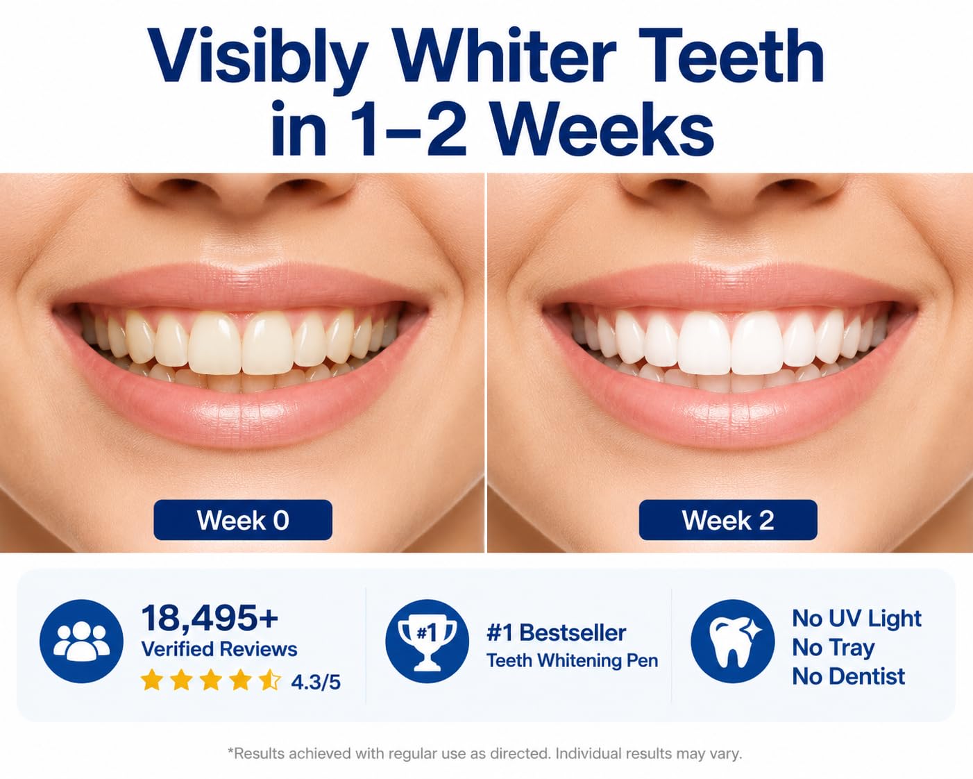 VieBeauti Teeth Whitening Pen - Whiter Teeth Fast -2 VieBeauti Teeth Whitening Pen - Whiter Teeth Fast -2