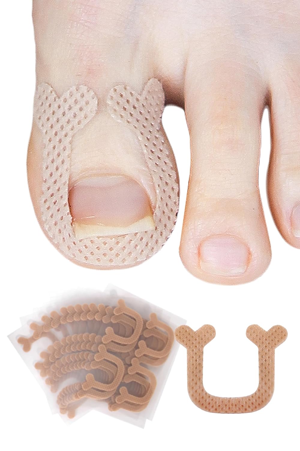 Pincher Pro Band Resistant Ingrown Toenail