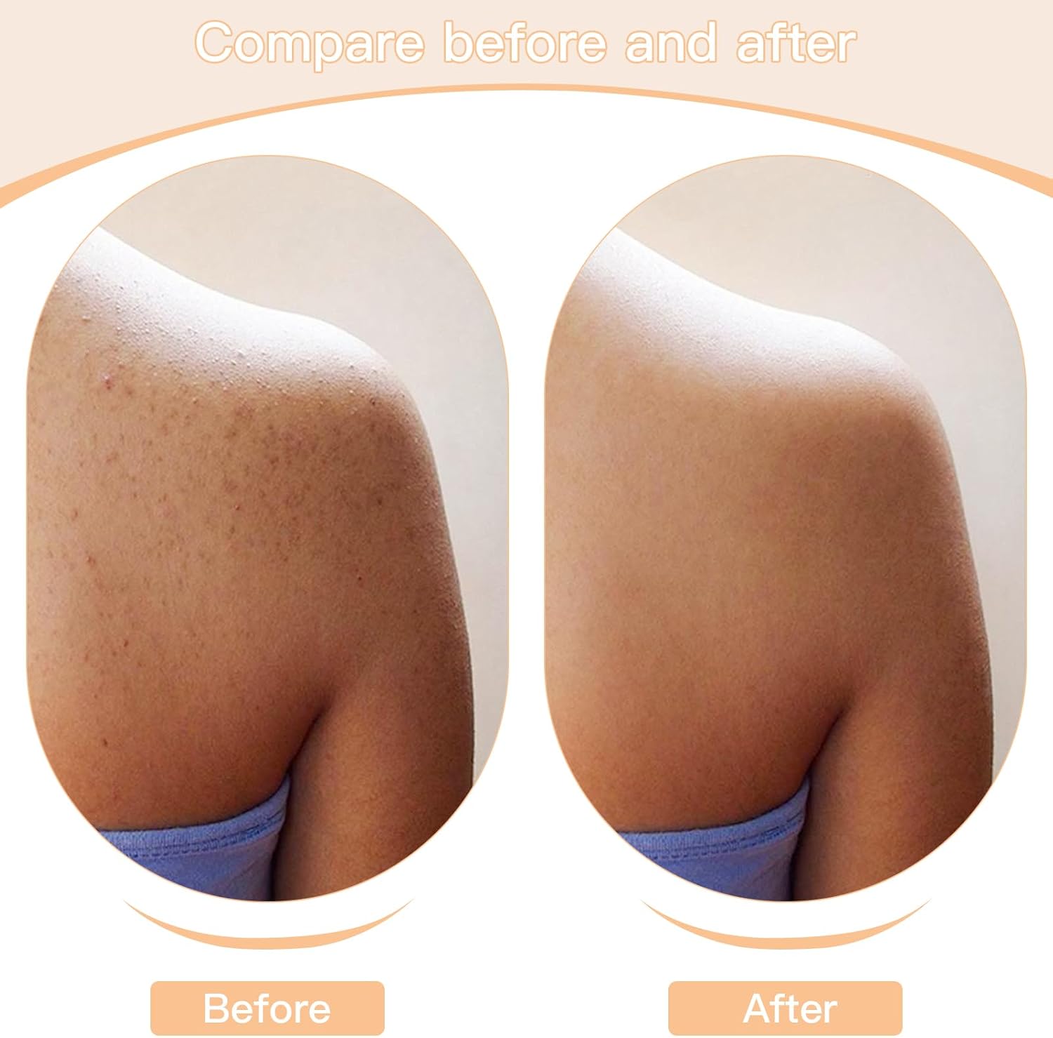 1 Pack Exfoliating Body Brushes - Dry Brush - Shower Scrubber for Body, Dry Brushing Body Brush for Lymphatic Drainage, Body Exfoliating Brush with Massage Nodes for Soft & Smooth Skin - Image 6