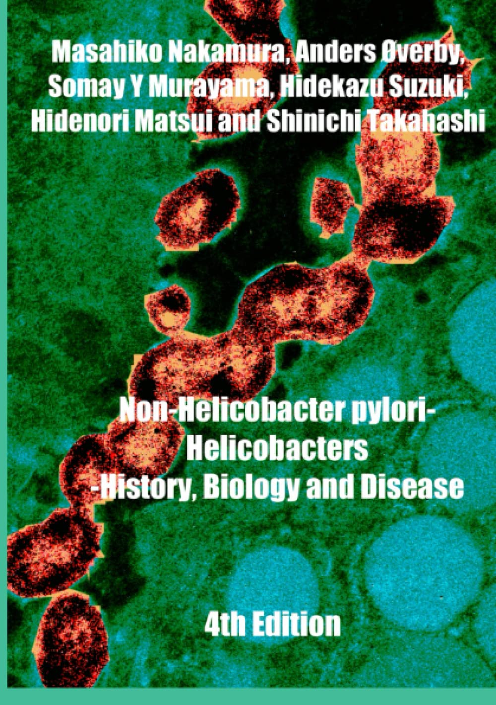 Amazon.co.jp: non-Helicobacter pylori Helicobacter history