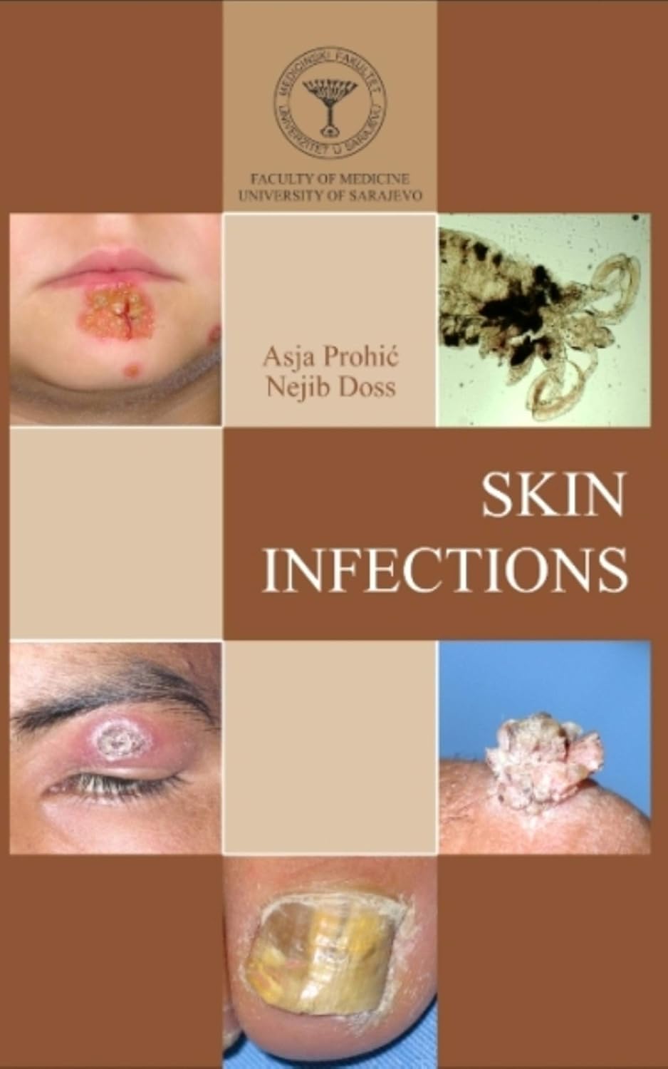 Skin Infections      Kindle Edition