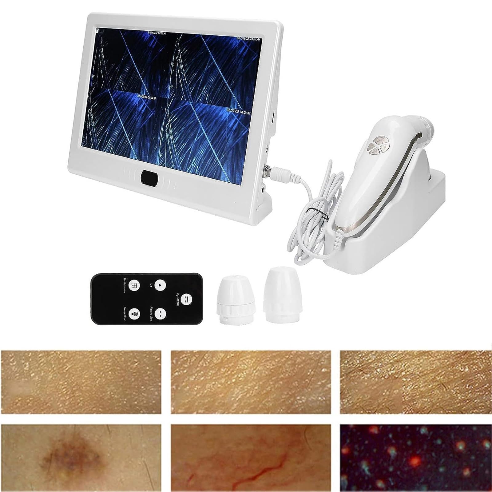 Détecteur de peau et de cuir chevelu, 13 pouces, analyseur de peau numérique, testeur d'humidité, analyseur de peau et de follicules pileux rechargeable