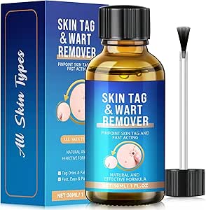 Wart Remover,Fast-Acting Skin Tag & Wart Remover for Feet & Hands,Skin Tag Removal Kit Effective Treatment for Plantar and Common Warts,Flat Warts,Corns,and Calluses Natural & Safe (30ML)
