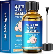 Wart Remover,Fast-Acting Skin Tag & Wart Remover for Feet & Hands,Skin Tag Removal Kit Effective Treatment for Plantar and Common Warts,Flat Warts,Corns,and Calluses Natural & Safe