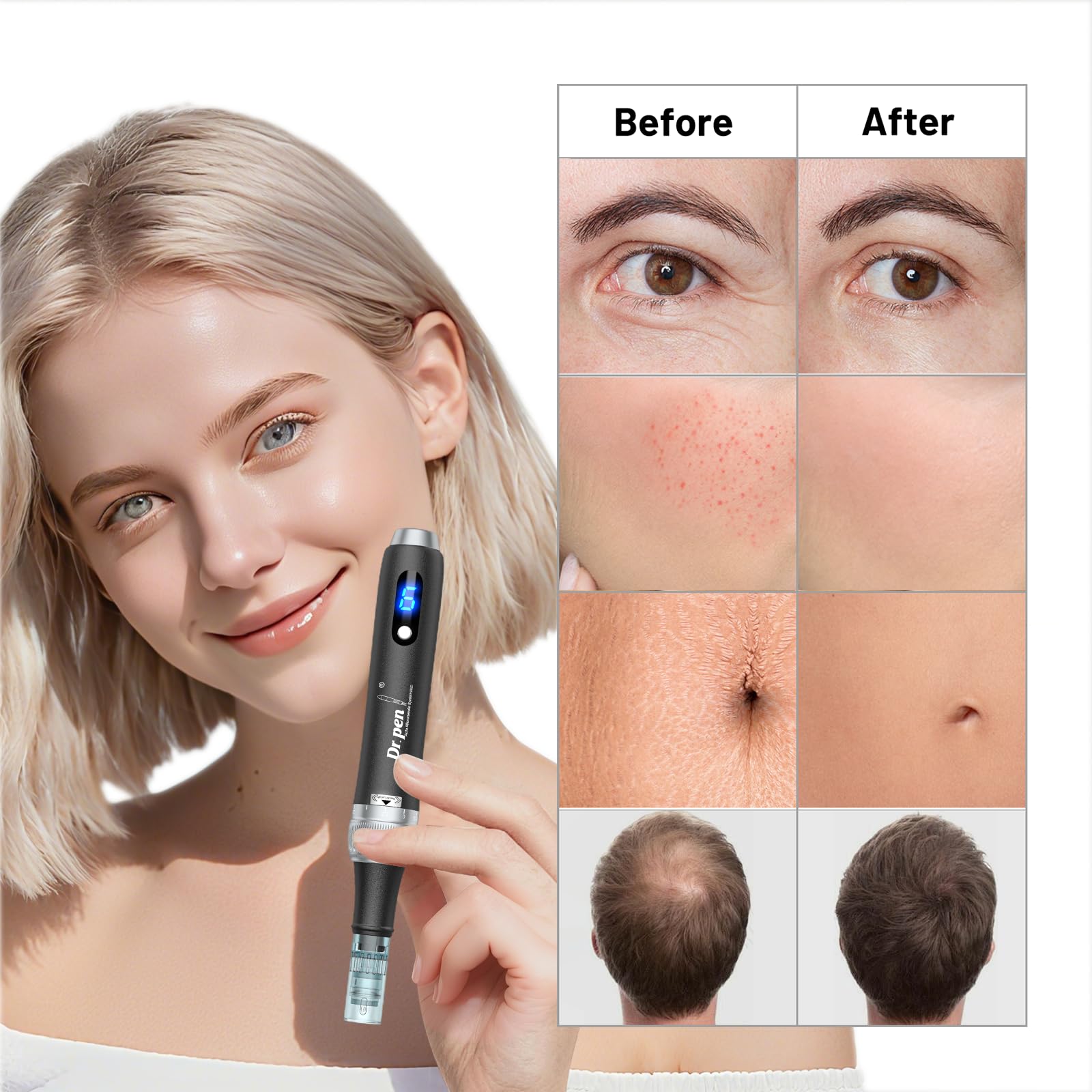 Dr. Pen 2026 Ultima M7S Professioneller Microneedling Pen, Kabellos mit 25 Ersatzkartuschen, 6 Stufen und LED-Anzeige Elektrischer Dermapen für Haarwachstum, Gesicht, Körper und Hautpflege