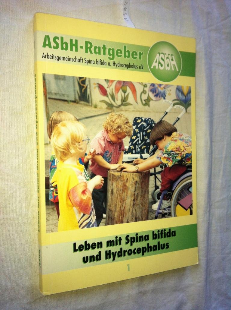 Amazon.co.jp: Leben mit Spina bifida und Hydrocephalus: Ein Ratgeber : 本