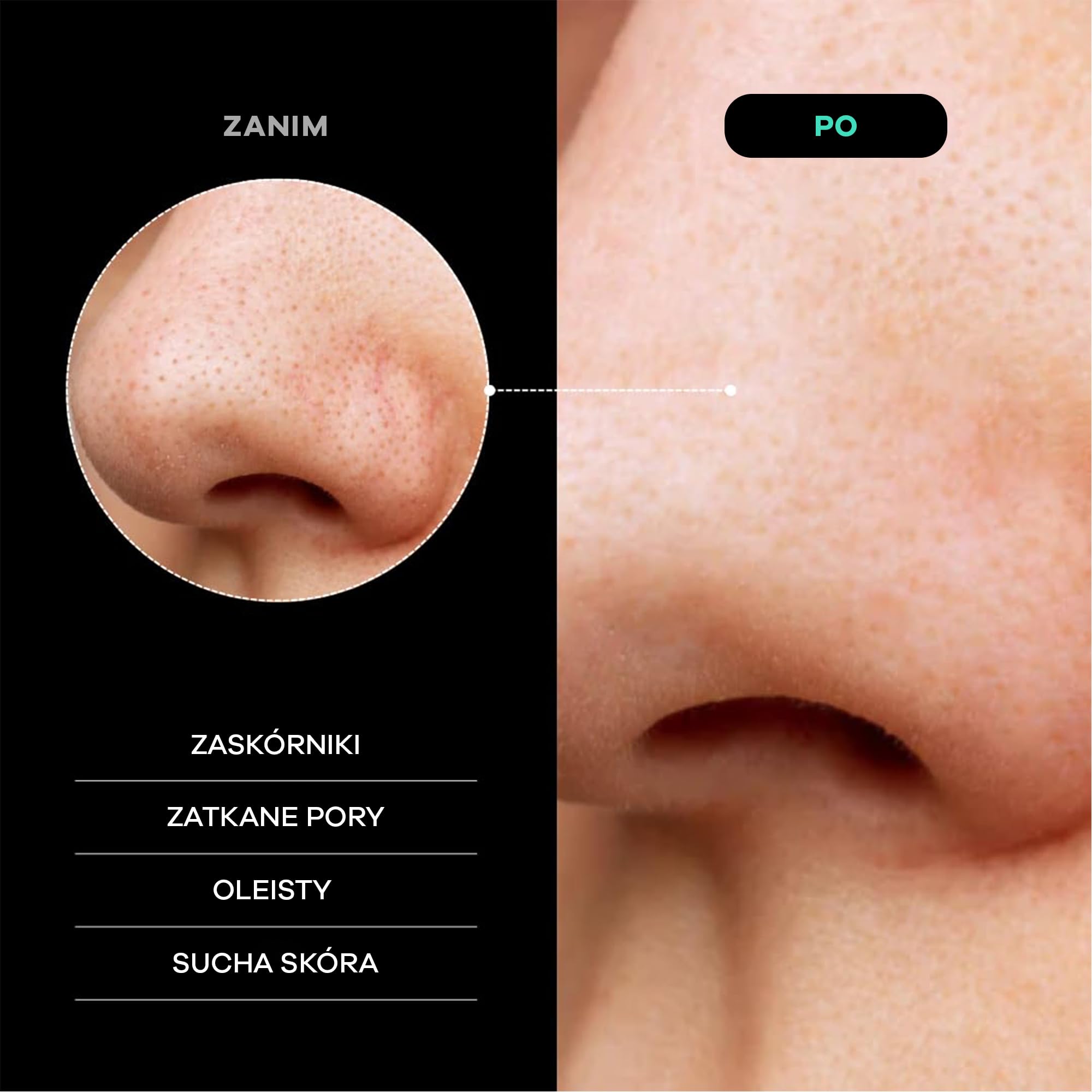Dermasuri – Rękawica Złuszczająca do Twarzy – Koreański Peeling na Mokro i Sucho – Usuwa Martwy Naskórek i Zanieczyszczenia – Dla Wszystkich Typów Skóry – Prezent Spa Kobiety Mężczyźni – 1 Sztuka
