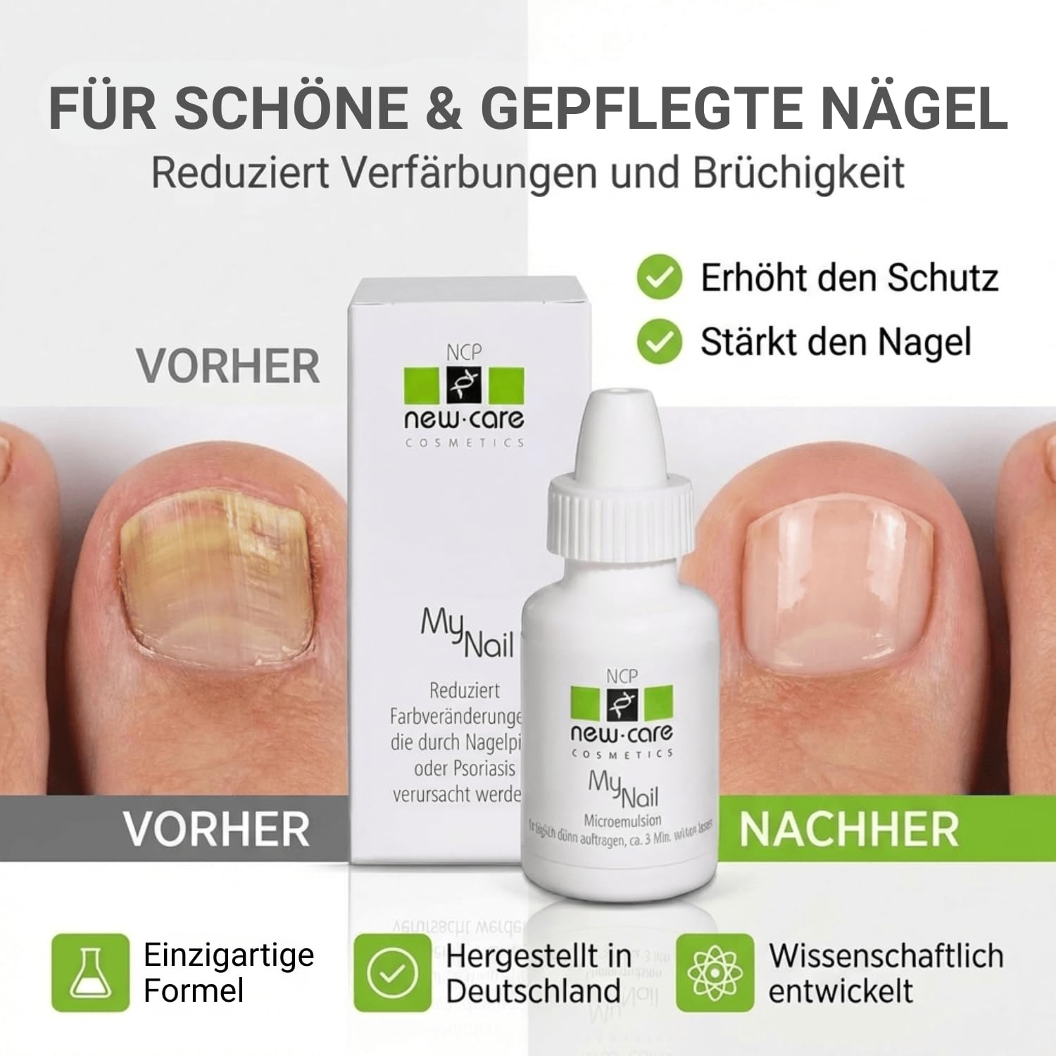 MyNail Nagelserum - 10 ml – Nagelkur, bei Nagelpilz und gegen brüchige Nägel - ohne Feilen - Nagelpflege, Nagelhärter zur Wiederherstellung schöner und glänzender Nägel