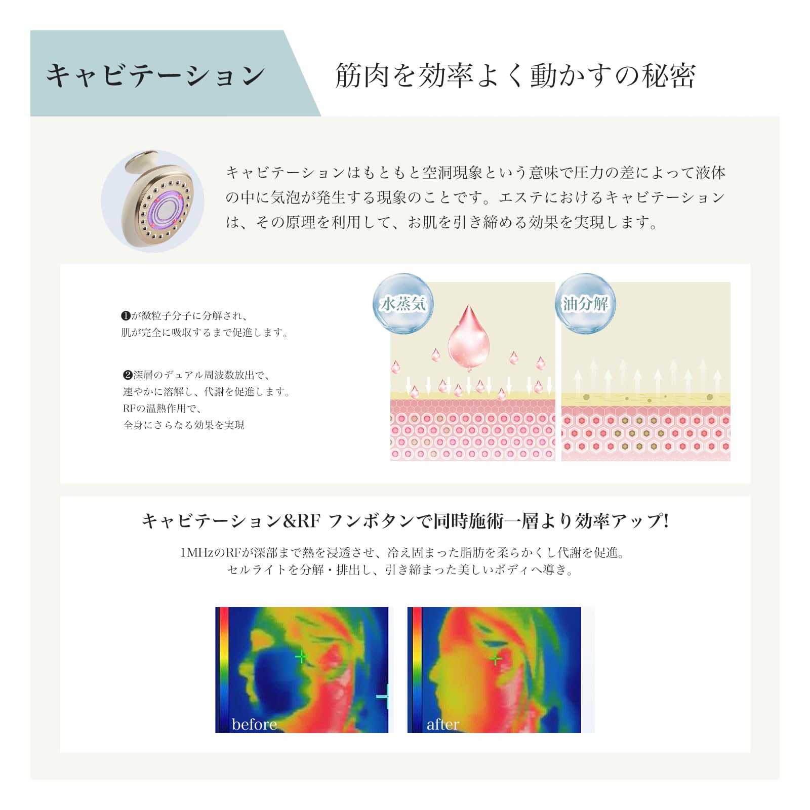 Amazon.co.jp: FIIL 美顔器 複合美容器 超音波RF搭載 EMS 5段階の強度