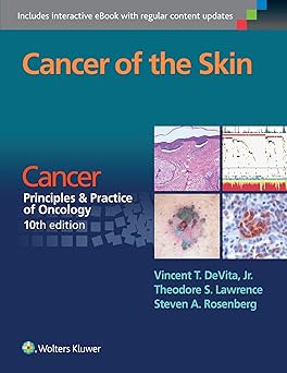 Cancer Of The Skin Cancer Principles And Practice Of Oncology 10Ed (Pb 2016)