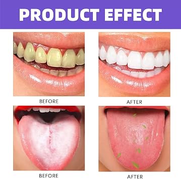 Fruit Oral Breath Spray,Pro-Biotic Oral Spray,Breath Freshener Spray,Oral Care Spray,Long-Lasting Mouth Freshener,Mouth Spray for Bad Breath,Breath Fresheners for Adults,Dry Mouth Spray,Orange