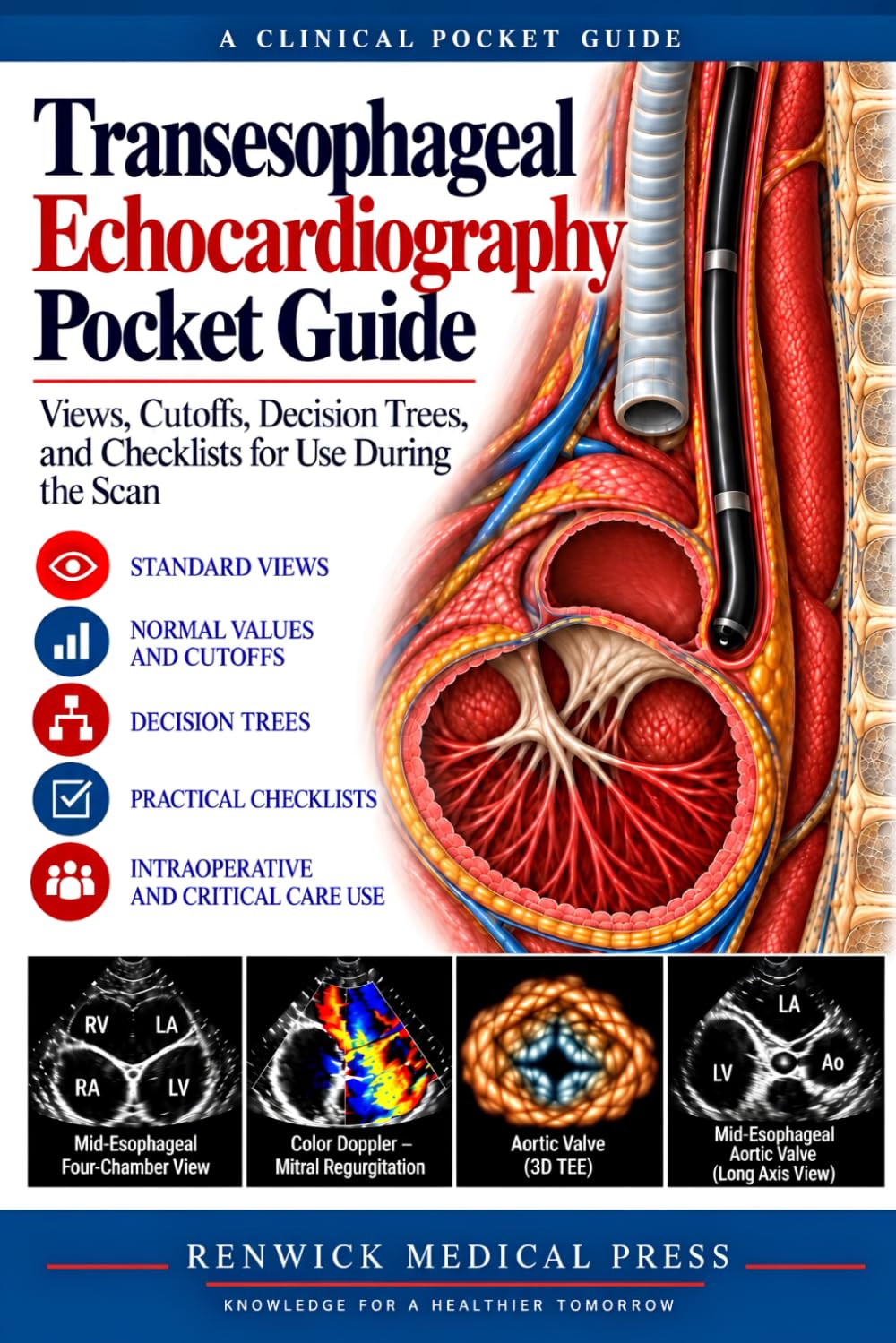 Transesophageal Echocardiography Pocket Guide: Views, Cutoffs, Decision Trees, and Checklists for Use During the Scan