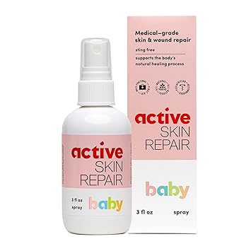Active Skin Repair Natural, Non-Toxic, No Sting Baby Spray First Aid Safe For Use on Diaper Rash, Baby Acne, Eczema, Cuts, Wounds, Scrapes, and Other Skin Irritations 3 oz. Spray